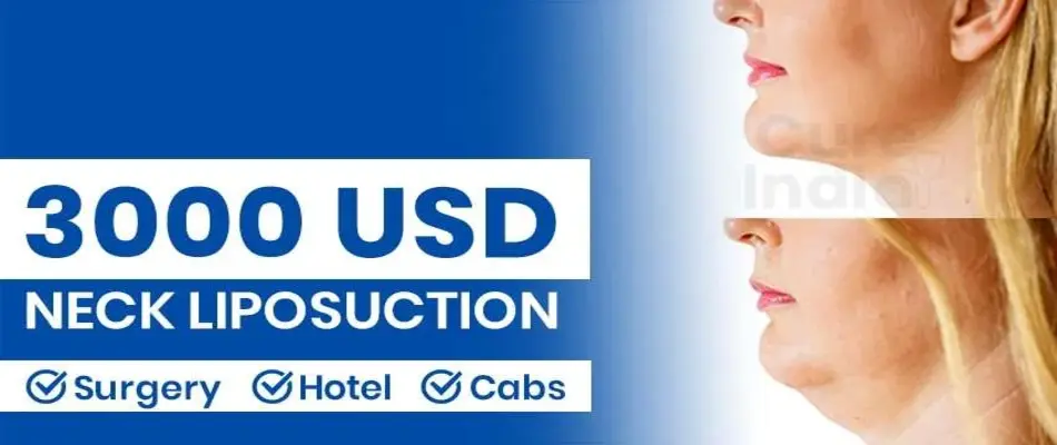 Neck Liposuction Cost
